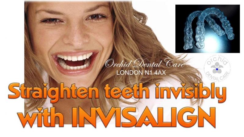 Invisalign,clear braces